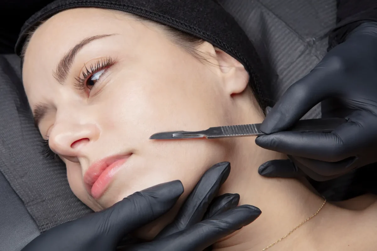 Dermaplaning, in Draper, UT Dermaplaning in Draper, UT at Sotto Aesthetics
