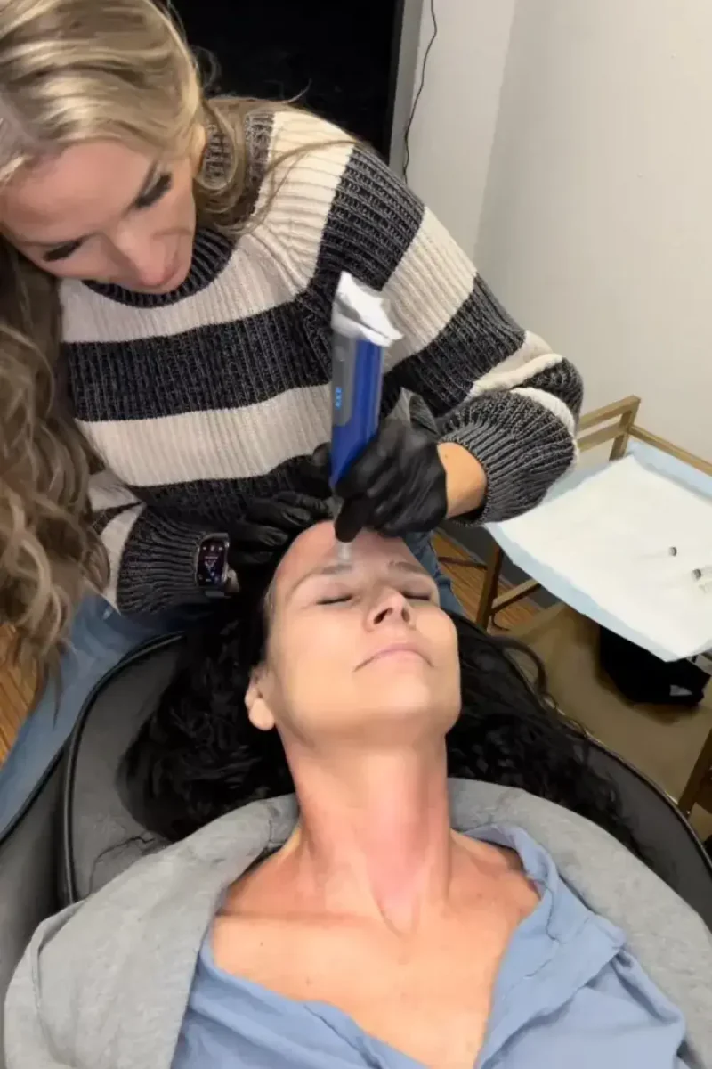 Beauty Treatment for a female by the Sotto Aesthetics staff