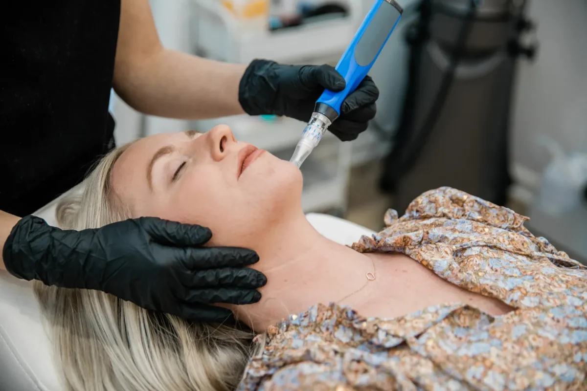 PRP Microneedling in Draper, UT PRP Microneedling in Draper, UT