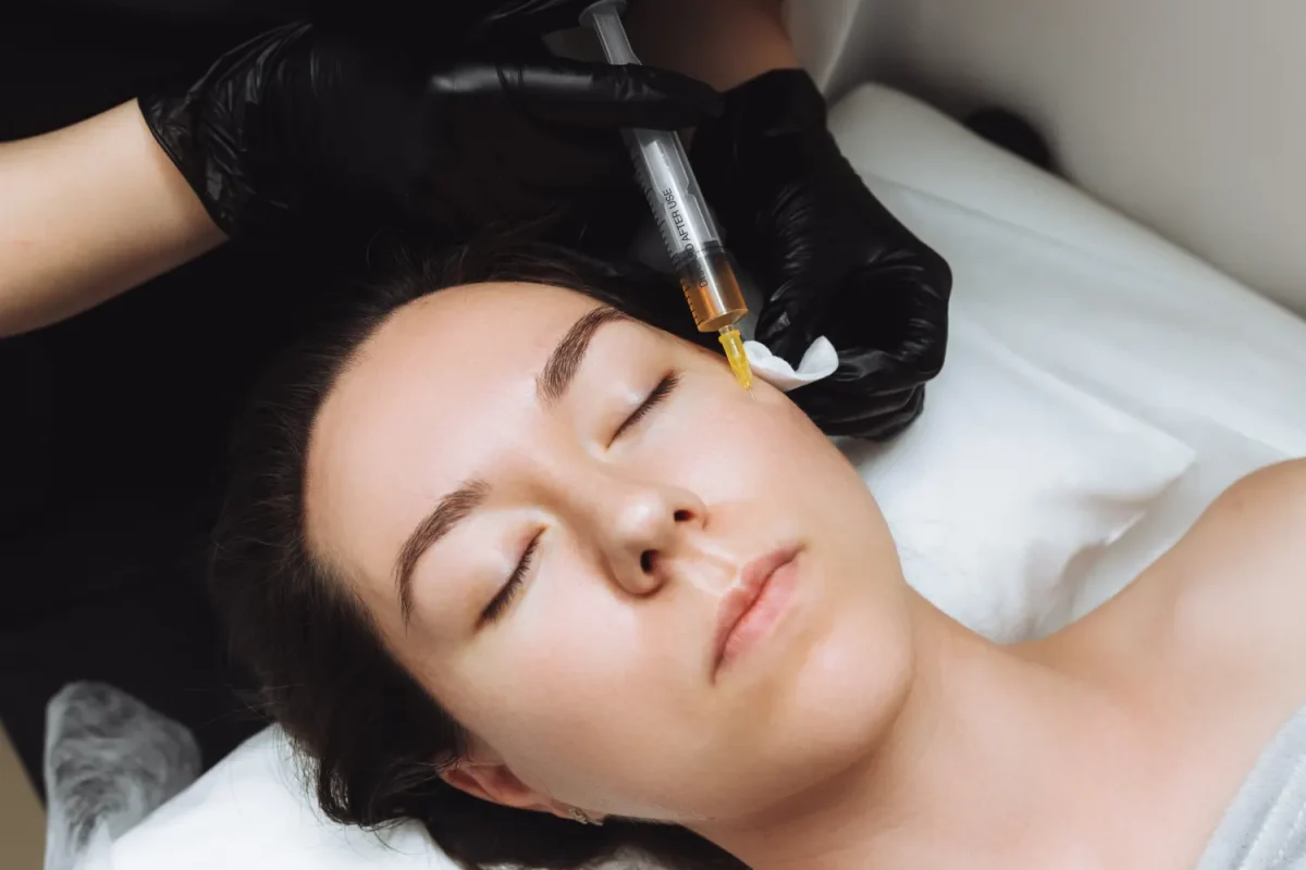 plasma-fillers-in-draper-ut Plasma Fillers in Draper, UT at Sotto Aesthetics